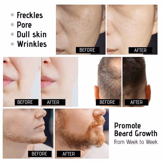 Hot Sell Private Label Matt Micro Needle Matte Black 540 Derma Roller